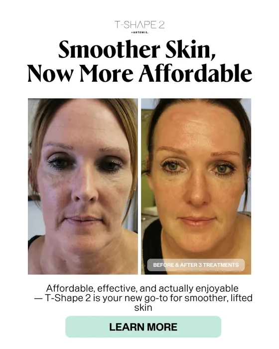 Low-level laser therapy treatment